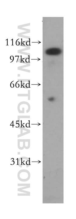 PSMA/GCPII Rabbit anti-Human, Mouse, Rat, Polyclonal, Proteintech:Antibodies:Primary