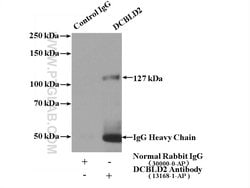 DCBLD2 Rabbit anti-Human, Mouse, Rat, Polyclonal, Proteintech 150 &mu;L;