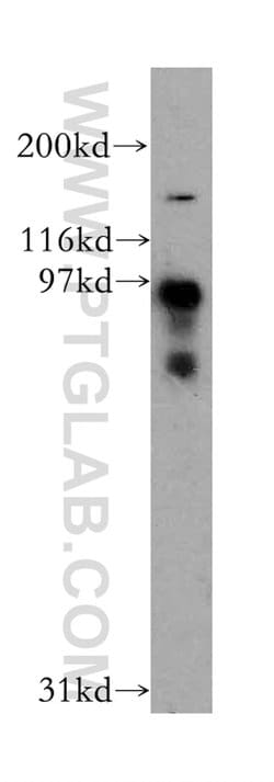 DCBLD2 Rabbit anti-Human, Mouse, Rat, Polyclonal, Proteintech 150 &mu;L;