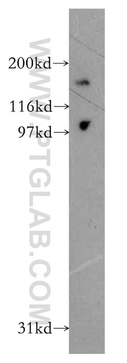 DCBLD2 Rabbit anti-Human, Mouse, Rat, Polyclonal, Proteintech 150 &mu;L;