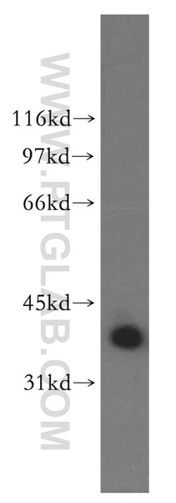QKI Rabbit anti-Human, Mouse, Rat, Polyclonal, Proteintech:Anticuerpos:Anticuerpos
