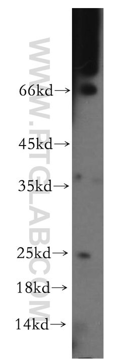 CIDEA Rabbit anti-Human, Mouse, Rat, Polyclonal, Proteintech 150 &mu;L;