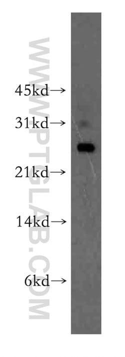 Proteintech UBTD2 Rabbit anti-Human, Mouse, Rat, Polyclonal, Proteintech