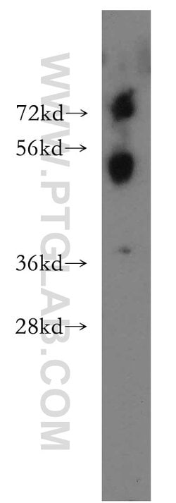 CDS2 Rabbit anti-Human, Mouse, Rat, Polyclonal, Proteintech 150 &mu;L;