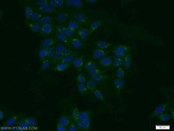 TBX5 Rabbit anti-Human, Mouse, Rat, Polyclonal, Proteintech:Antibodies:Primary
