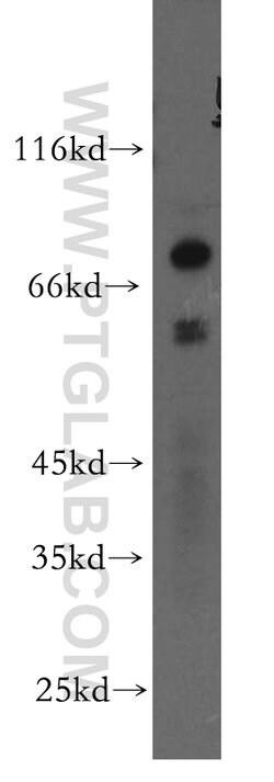 TBX5 Rabbit anti-Human, Mouse, Rat, Polyclonal, Proteintech:Antibodies:Primary