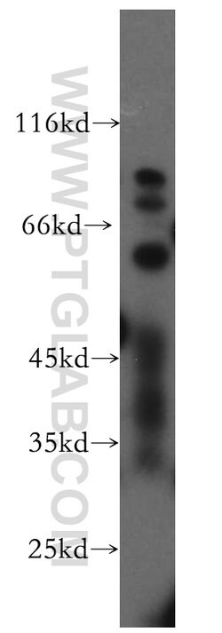 TBX5 Rabbit anti-Human, Mouse, Rat, Polyclonal, Proteintech:Antibodies:Primary