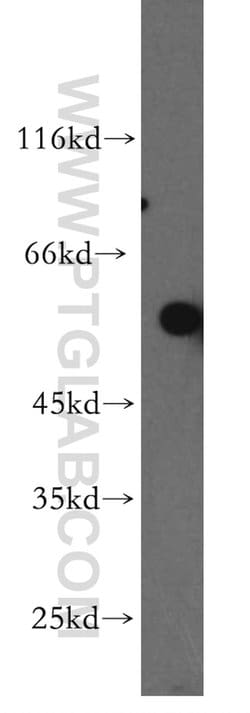 TBX5 Rabbit anti-Human, Mouse, Rat, Polyclonal, Proteintech:Antibodies:Primary