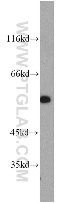 STAT5A Rabbit anti-Human, Mouse, Rat, Polyclonal, Proteintech 150 &mu;L;