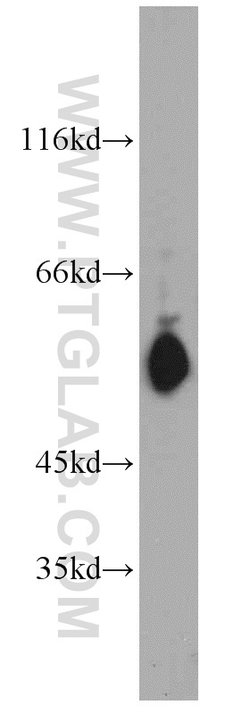 STAT5A Rabbit anti-Human, Mouse, Rat, Polyclonal, Proteintech 150 &mu;L;