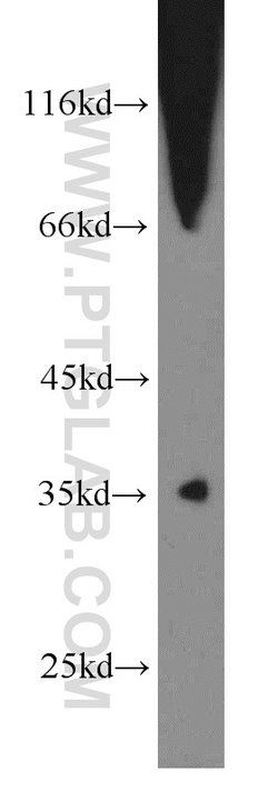 SNX20 Rabbit anti-Human, Mouse, Rat, Polyclonal, Proteintech:Antibodies:Primary
