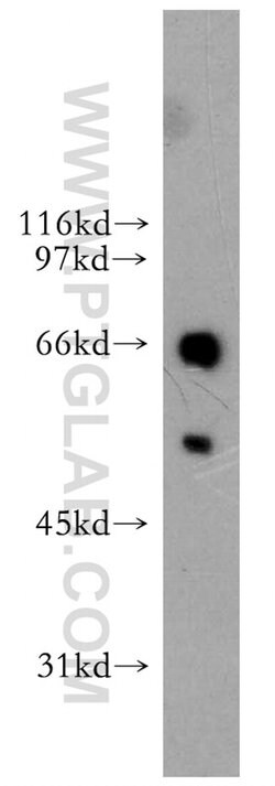 ETV6 Rabbit anti-Human, Mouse, Rat, Polyclonal, Proteintech:Antibodies:Primary