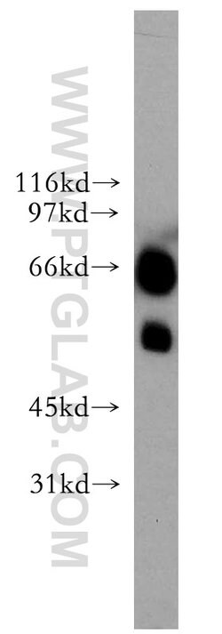 ETV6 Rabbit anti-Human, Mouse, Rat, Polyclonal, Proteintech:Antibodies:Primary