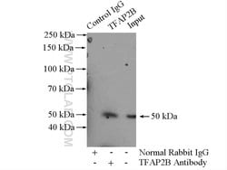 TFAP2B Rabbit anti-Human, Mouse, Rat, Polyclonal, Proteintech 150 &mu;L;