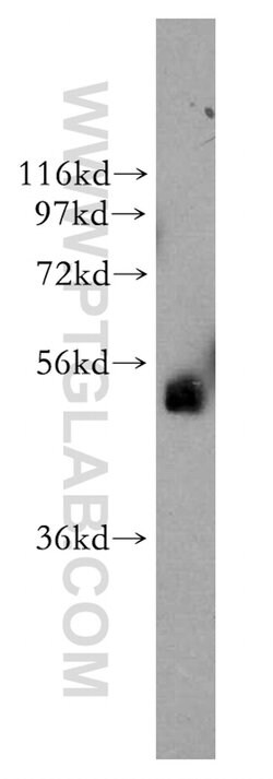 TFAP2B Rabbit anti-Human, Mouse, Rat, Polyclonal, Proteintech 150 &mu;L;