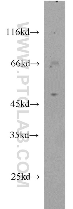TFAP2B Rabbit anti-Human, Mouse, Rat, Polyclonal, Proteintech 150 &mu;L;