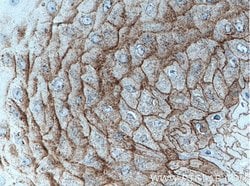 CDSN Rabbit anti-Human, Mouse, Polyclonal, Proteintech:Antibodies:Primary