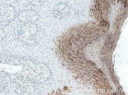 CDSN Rabbit anti-Human, Mouse, Polyclonal, Proteintech:Antibodies:Primary