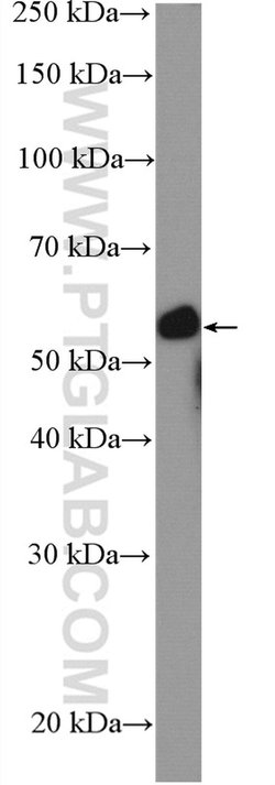 CDSN Rabbit anti-Human, Mouse, Polyclonal, Proteintech:Antibodies:Primary