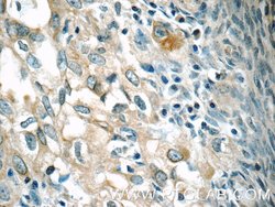 RAB25 Rabbit anti-Human, Polyclonal, Proteintech 150 &mu;L; Unconjugated:Antibodies,