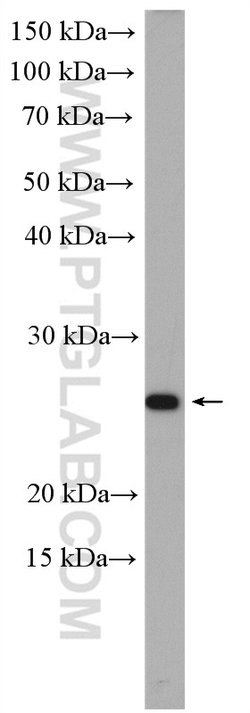 RAB25 Rabbit anti-Human, Polyclonal, Proteintech 150 &mu;L; Unconjugated:Antibodies,