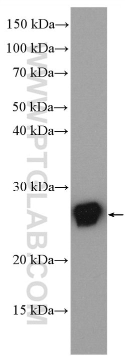 RAB25 Rabbit anti-Human, Polyclonal, Proteintech 150 &mu;L; Unconjugated:Antibodies,