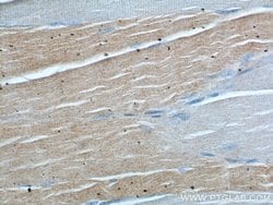 PPM1B Rabbit anti-Human, Mouse, Rat, Polyclonal, Proteintech 150 &mu;L;