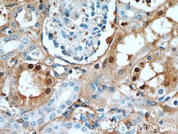 FXR1 Rabbit anti-Human, Mouse, Rat, Polyclonal, Proteintech:Antibodies:Primary