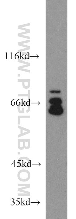 FXR1 Rabbit anti-Human, Mouse, Rat, Polyclonal, Proteintech:Antibodies:Primary