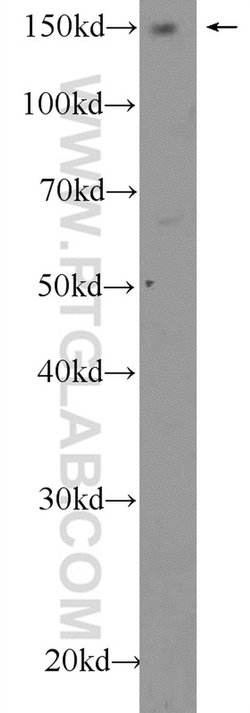 AFF4 Rabbit anti-Human, Mouse, Rat, Polyclonal, Proteintech 150 &mu;L;