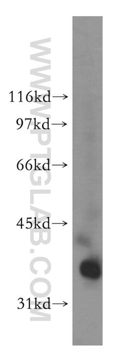 PDLIM3 Rabbit anti-Human, Mouse, Rat, Polyclonal, Proteintech 150 &mu;L;