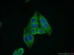 DCLRE1B Rabbit anti-Human, Mouse, Rat, Polyclonal, Proteintech 150 &mu;L;