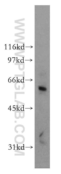 DCLRE1B Rabbit anti-Human, Mouse, Rat, Polyclonal, Proteintech 150 &mu;L;