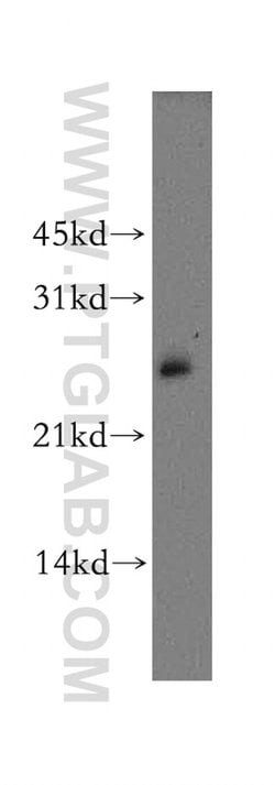 AK3L1 Rabbit anti-Human, Mouse, Rat, Polyclonal, Proteintech 150 &mu;L;