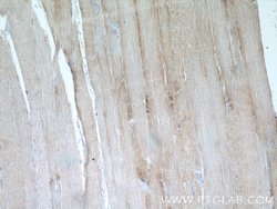 CKMT2 Rabbit anti-Human, Mouse, Rat, Polyclonal, Proteintech 150 &mu;L;