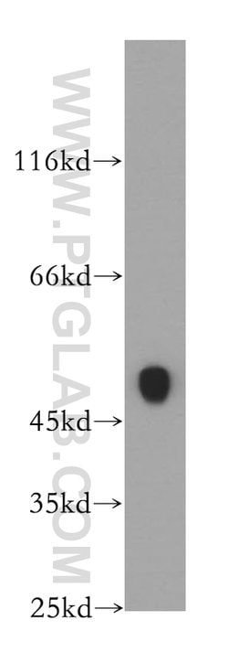 CKMT2 Rabbit anti-Human, Mouse, Rat, Polyclonal, Proteintech 150 &mu;L;