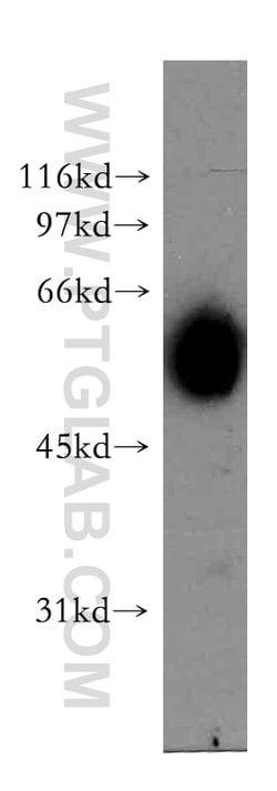 AKR7A3 Rabbit anti-Human, Mouse, Rat, Polyclonal, Proteintech:Antibodies:Primary