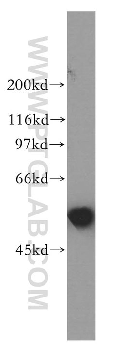 AKR7A3 Rabbit anti-Human, Mouse, Rat, Polyclonal, Proteintech:Antibodies:Primary