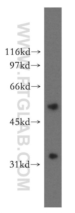 AKR7A3 Rabbit anti-Human, Mouse, Rat, Polyclonal, Proteintech:Antibodies:Primary