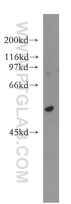 AKR7A3 Rabbit anti-Human, Mouse, Rat, Polyclonal, Proteintech:Antibodies:Primary