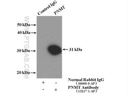 PNMT Rabbit anti-Human, Mouse, Rat, Polyclonal, Proteintech:Antibodies:Primary