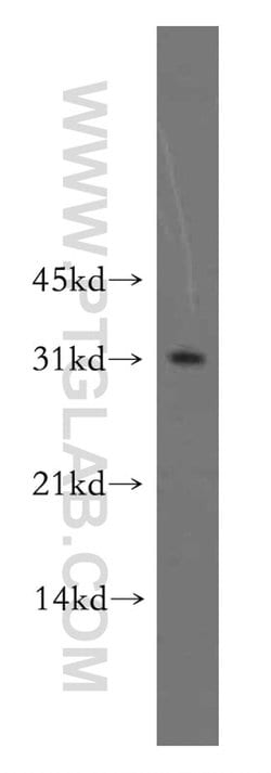 PNMT Rabbit anti-Human, Mouse, Rat, Polyclonal, Proteintech:Antibodies:Primary