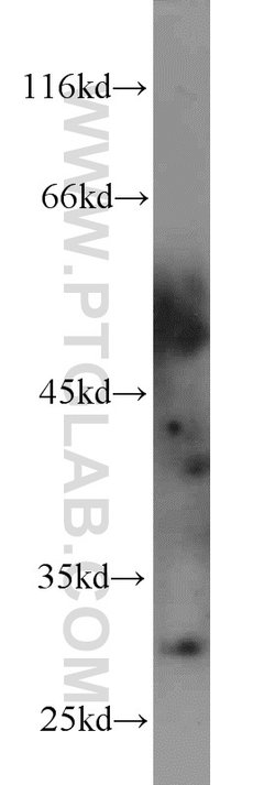 PNMT Rabbit anti-Human, Mouse, Rat, Polyclonal, Proteintech:Antibodies:Primary