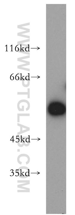 PIP4K2B Rabbit anti-Human, Mouse, Rat, Polyclonal, Proteintech 150 &mu;L;