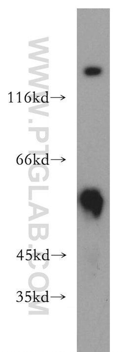 PIP4K2B Rabbit anti-Human, Mouse, Rat, Polyclonal, Proteintech 150 &mu;L;