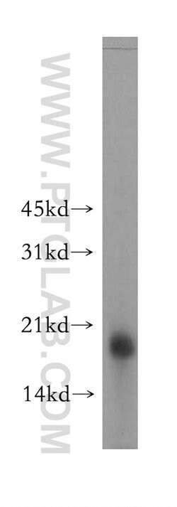RAMP2 Rabbit anti-Human, Mouse, Rat, Polyclonal, Proteintech 150 &mu;L;
