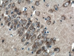 LRG1 Rabbit anti-Human, Mouse, Polyclonal, Proteintech 150 μL; Unconjugated:Antibodies,