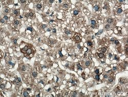 LRG1 Rabbit anti-Human, Mouse, Polyclonal, Proteintech 150 μL; Unconjugated:Antibodies,
