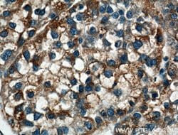 LRG1 Rabbit anti-Human, Mouse, Polyclonal, Proteintech 150 μL; Unconjugated:Antibodies,