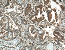 LRG1 Rabbit anti-Human, Mouse, Polyclonal, Proteintech 150 μL; Unconjugated:Antibodies,